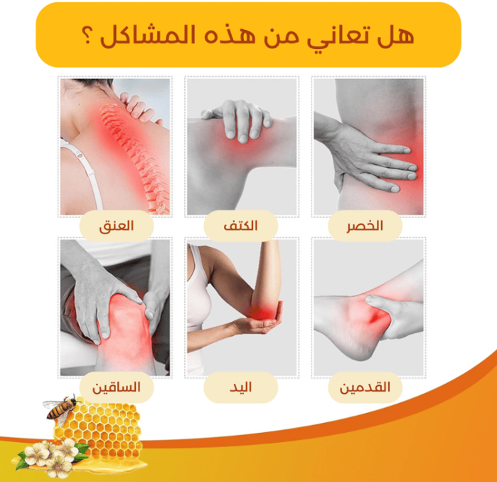 ⁦مرهم سم النحل لعلاج آلام المفاصل و العظام⁩ - الصورة ⁦3⁩