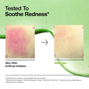 انوا سيروم حمض الأزيليك 30مل Anua 10+ Azelaic Acid Serum
